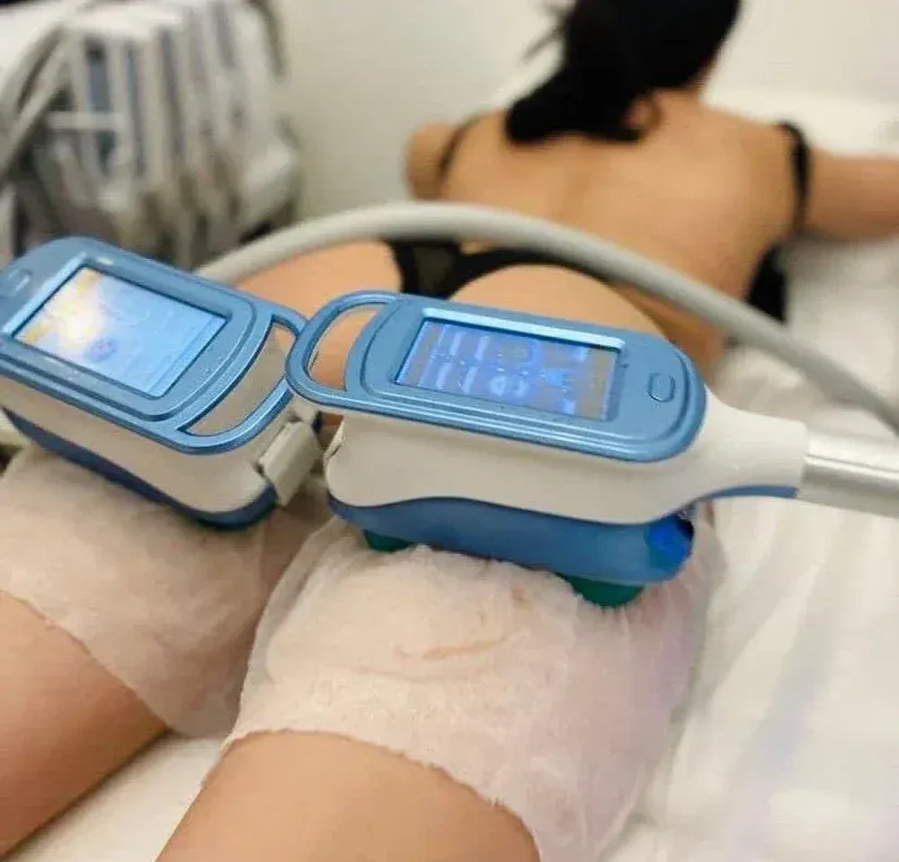 КРИОЛИПОЛИЗ