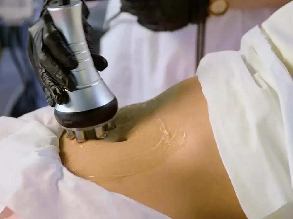 RF-Lifting тела и лица